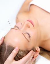 Acupuncture in coral springs florida